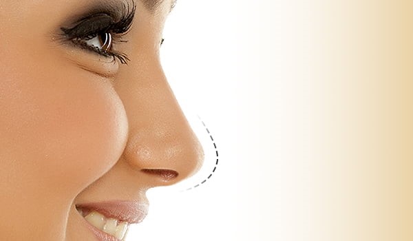بهترین سن عمل بینی