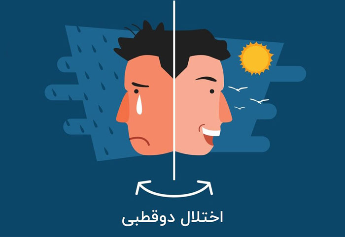 حالت افسردگی شدید در یک فرد با اختلال دوقطبی