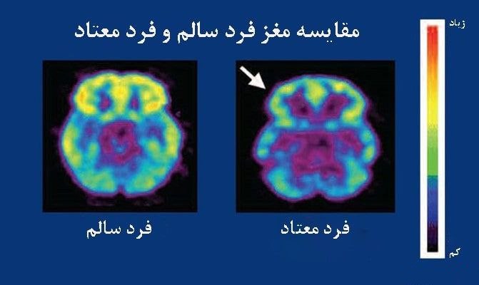 اثر اعتیاد بر روان