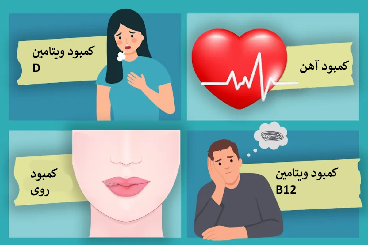 علائم کمبود ویتامین‌های مختلف چیست