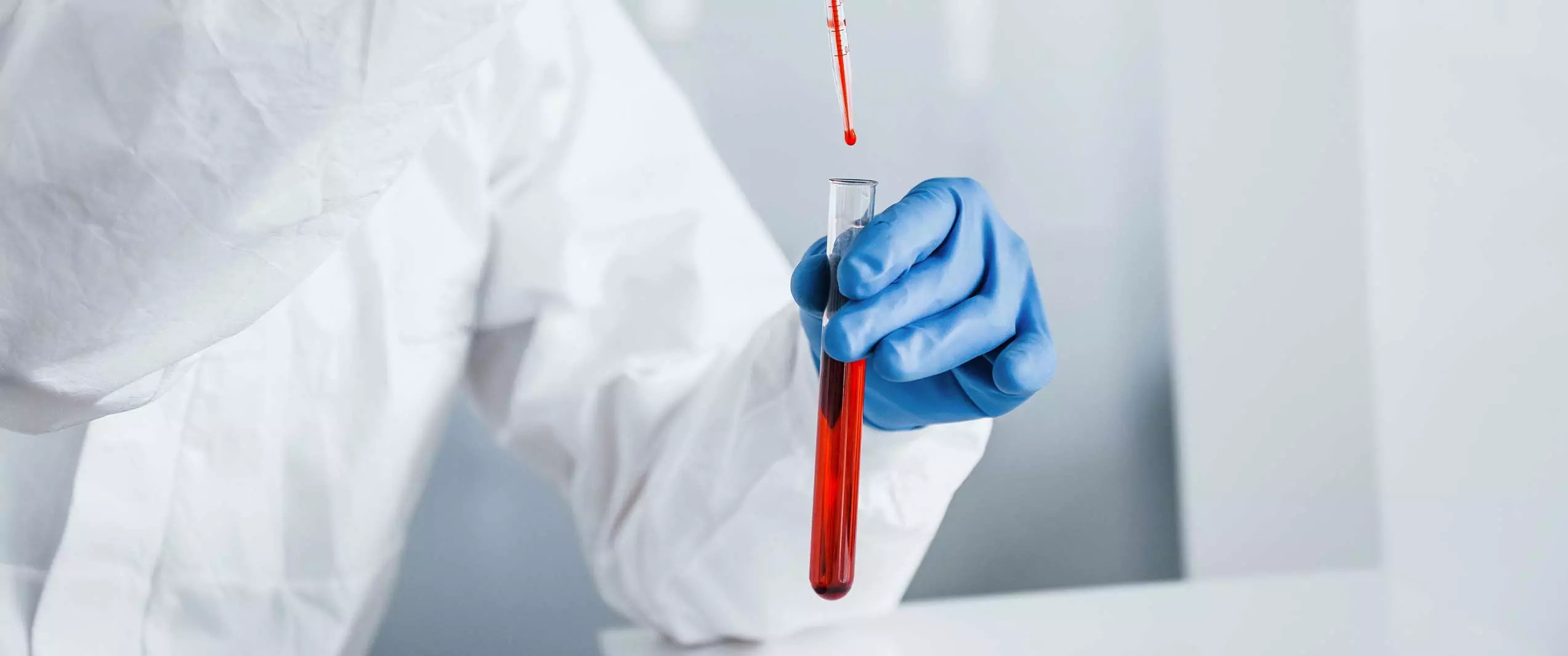 روش انجام تست کوبالامین